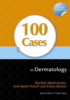 100_Cases_in_Dermatology_Powell.pdf